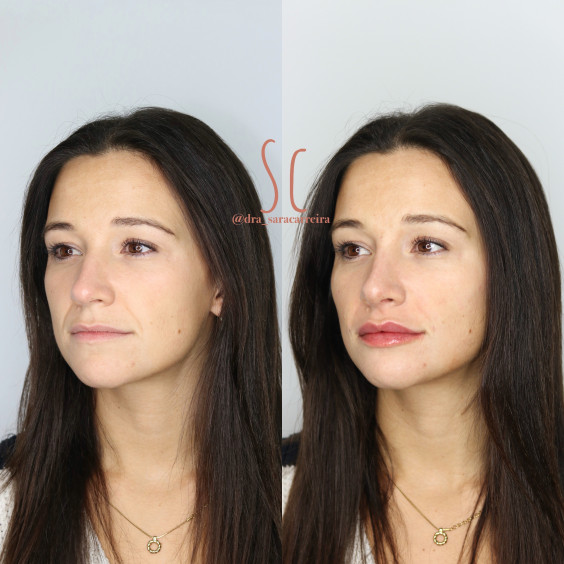 Full Face