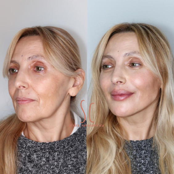 Full Face