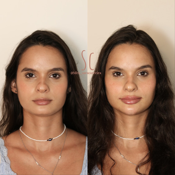 Full Face