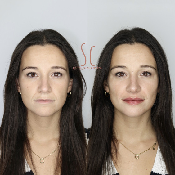 Full Face