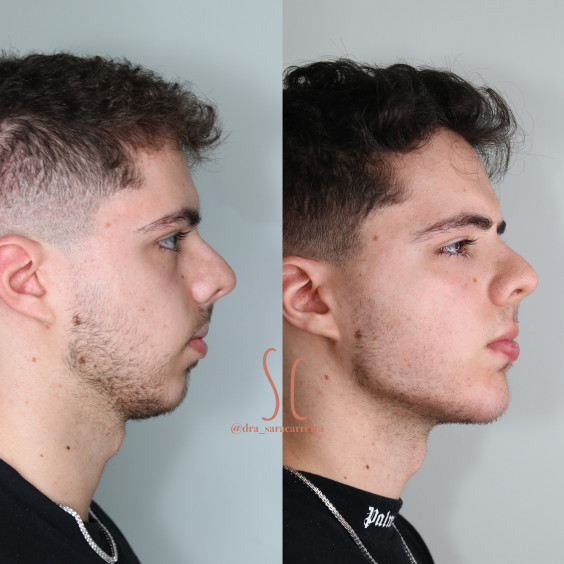 Harmonização Masculina