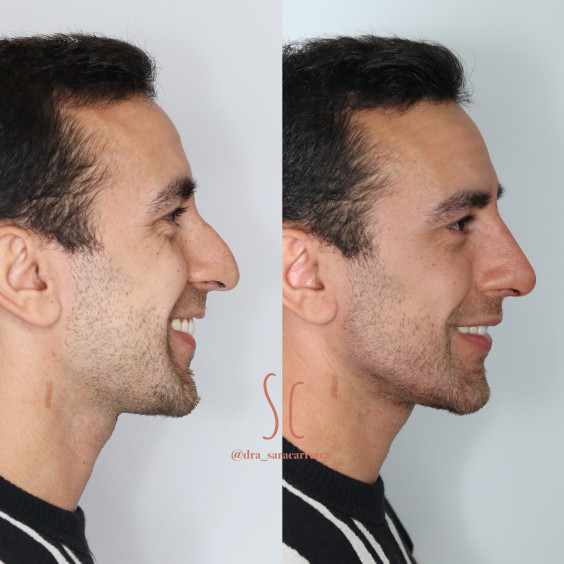 Harmonização Masculina